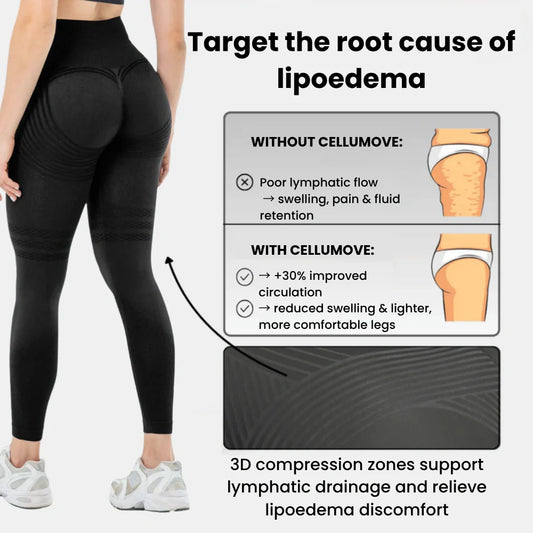 Legging 3D – lipedema de forma natural.